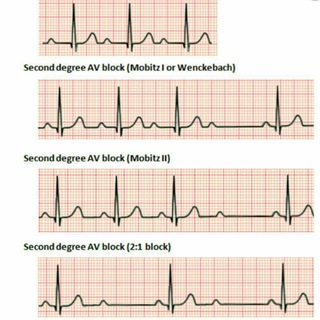 ECG (@electrocardiography)