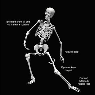 Science of Biomechanics, Sports Injuries, Pain and Musculoskeletal disorders (@exerciseismedicine)